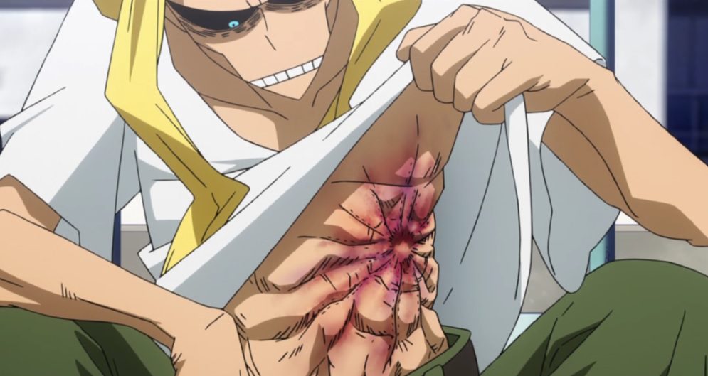 all might scar
